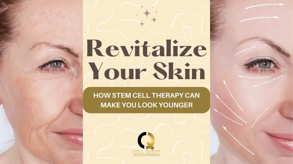 Skin Rejuvenation