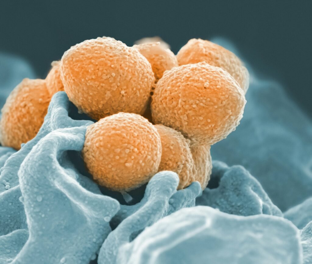 Colorized scanning electron microscope image of orange spherical bacteria clustered on a blue-tinted human cell surface.